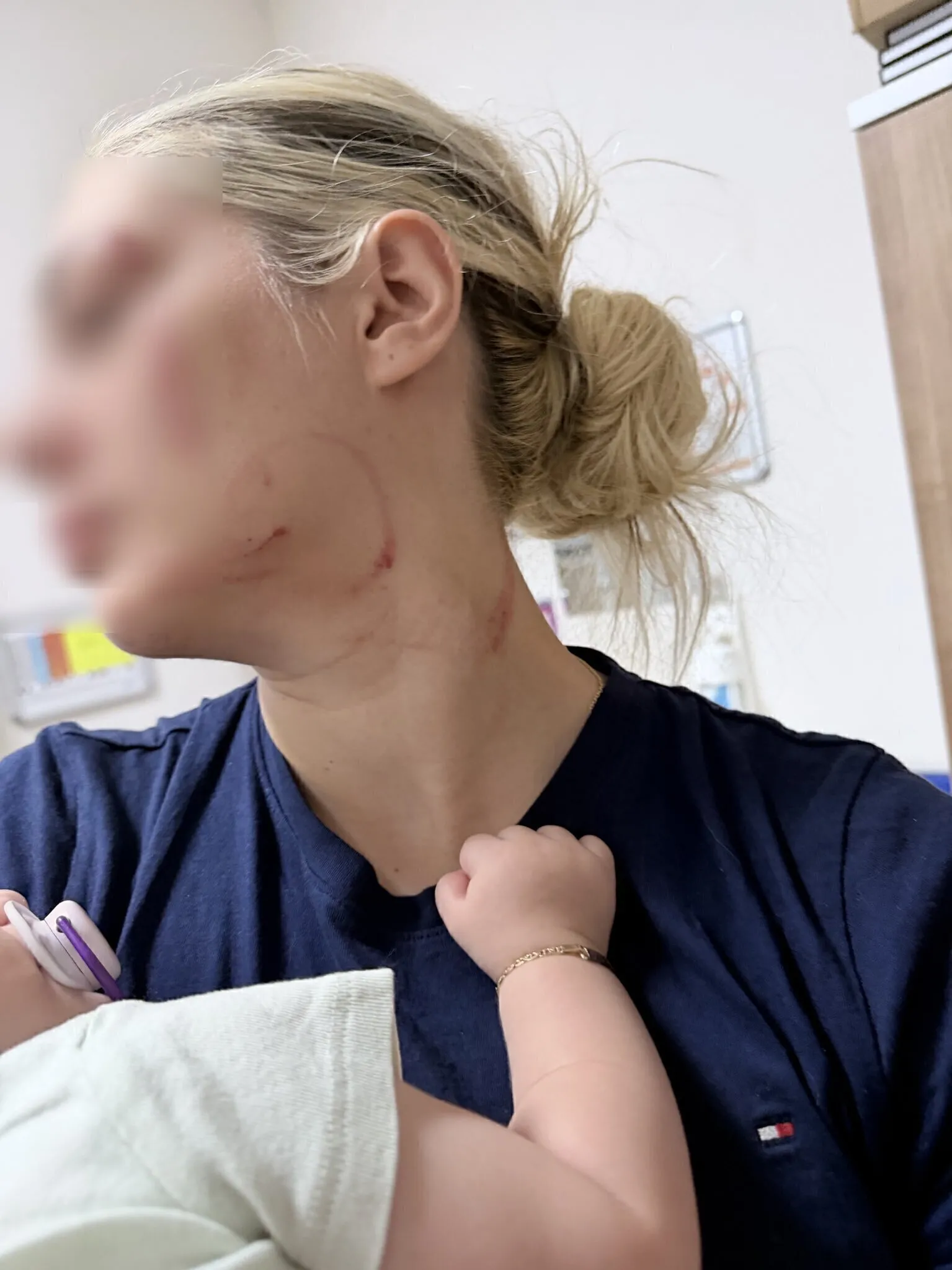 Aile Bakanlığı mağdur kadına destek verecek